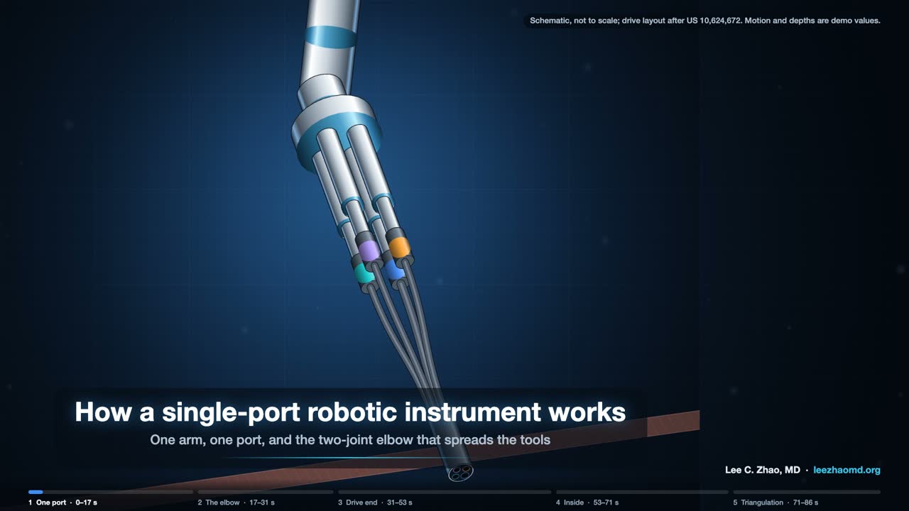 Title frame of the video: The single-port system